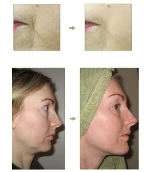 Aur de 24K Esența Lichid 10 Peptide FEG Puternic Anti Îmbătrânire Factor Capsule Ser Facial Crema de Albire de Reparare Buna rid