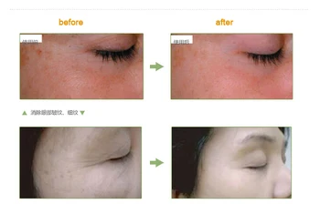 Aur de 24K Esența Lichid 10 Peptide FEG Puternic Anti Îmbătrânire Factor Capsule Ser Facial Crema de Albire de Reparare Buna rid