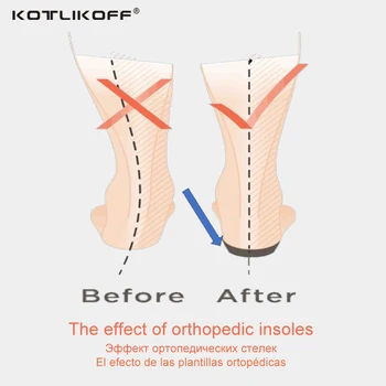 KOTLIKOFF 3D Ortezare Tălpi de picioare plate pentru copii și Copii Suport Arc branț pentru X-Picioarele copilului pantofi ortopedici Picior de Îngrijire
