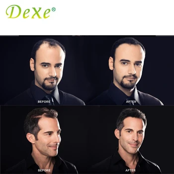 Dexe Hair Building Fibers Regenerarea Parului Pulbere de Păr Keratina Fibre 8g/10g/22g